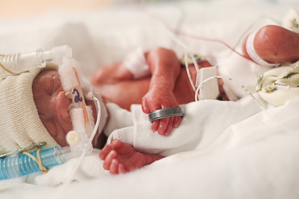 NICU baby with ring