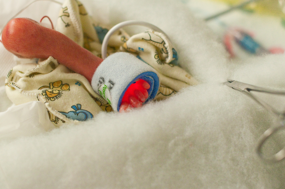 NICU baby foot