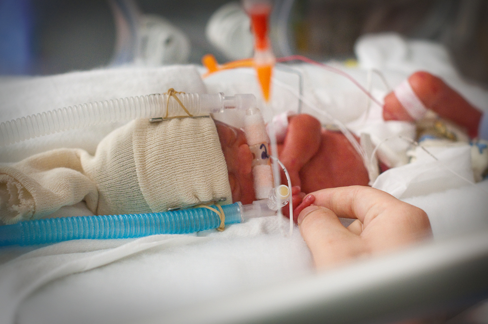 NICU Infant with Adult Hand